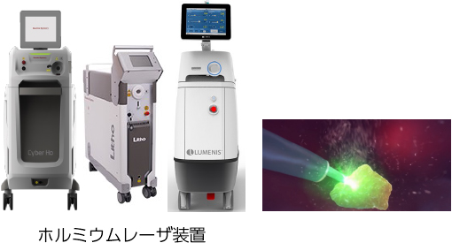 ホルミウムレーザー装置